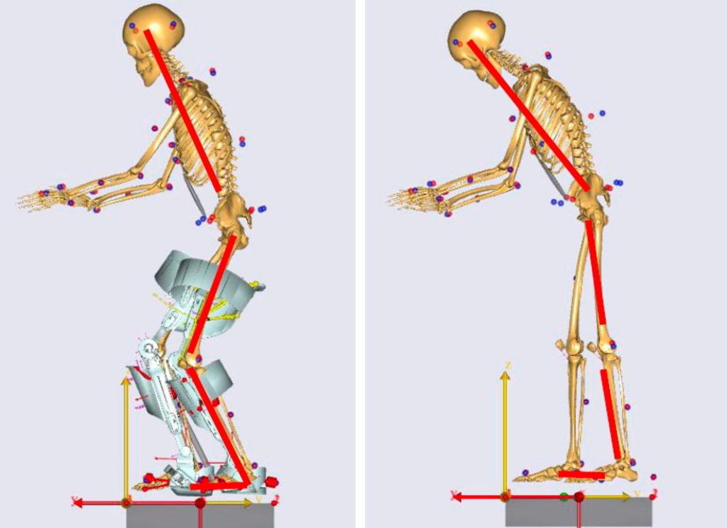 筋骨格解析モデル　アルケリスの有無における比較